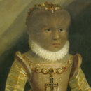 Это портрет XVI века с изображением Антуанетты Гонсалес. Как называется ее болезнь?
